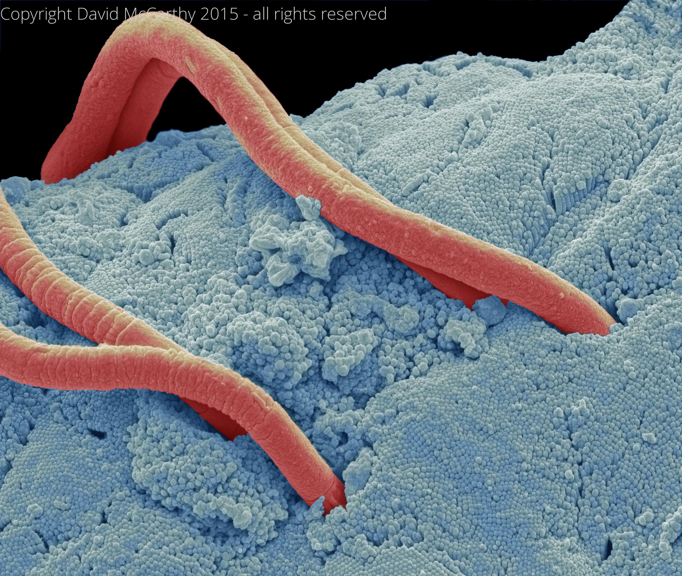 Image gallery David McCarthy Electron Microscopist