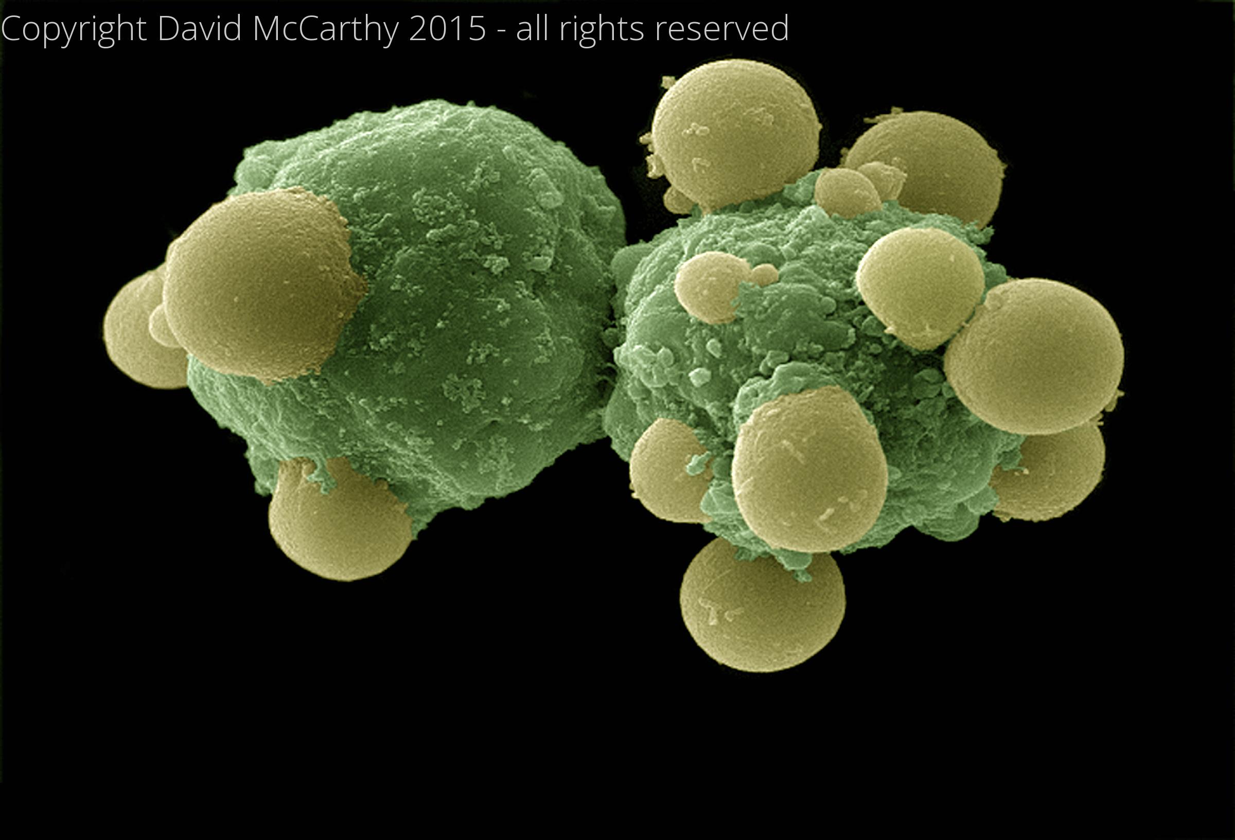 Hepatocytes Apoptosis